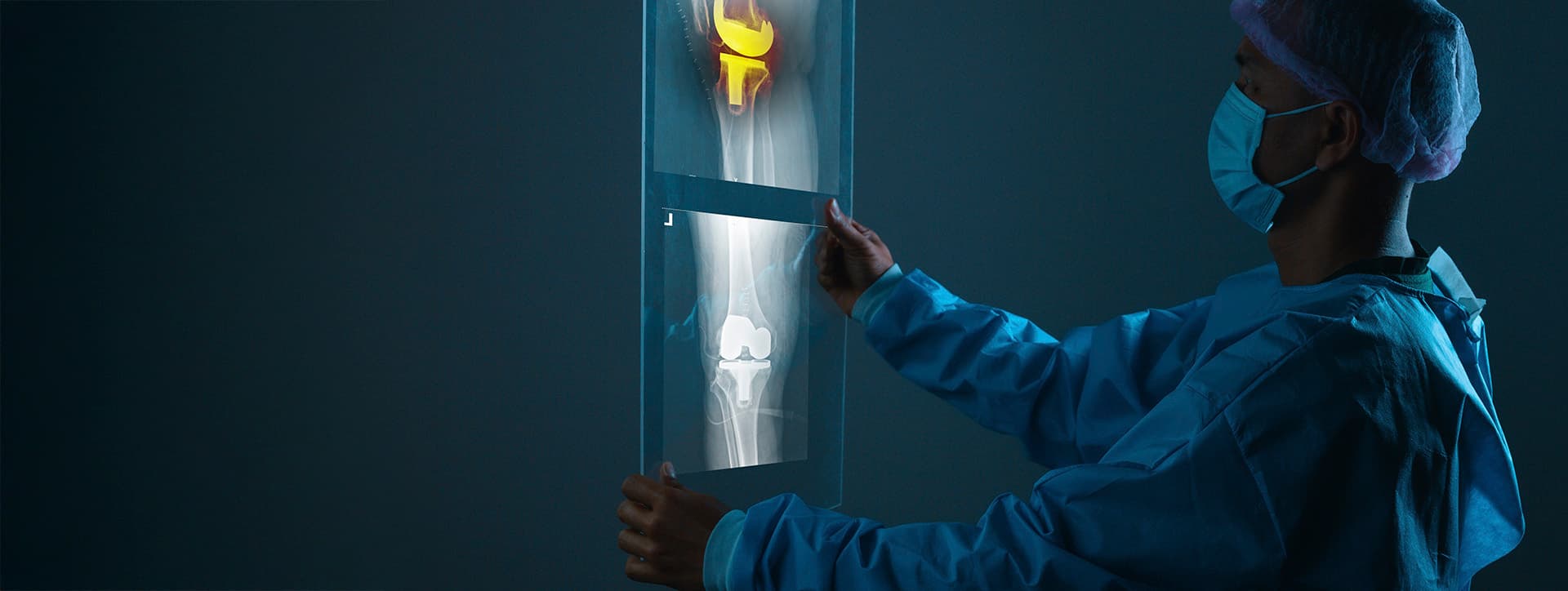 Diagnóstico preciso de lesões do joelho