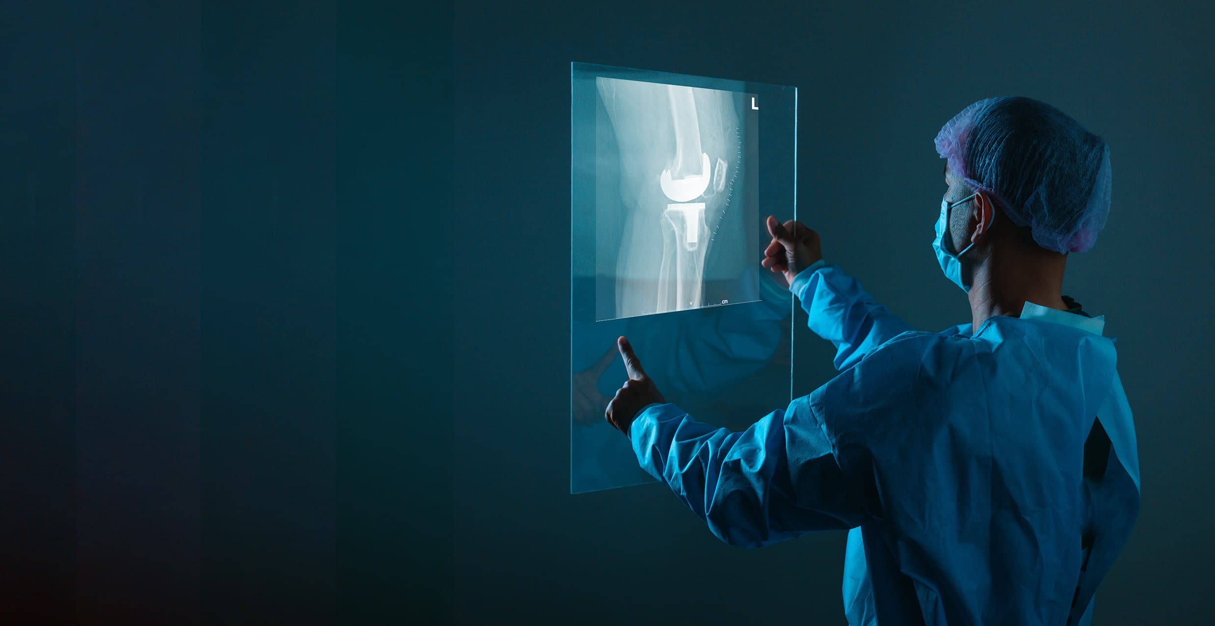 Diagnóstico e lesões associadas à artrose